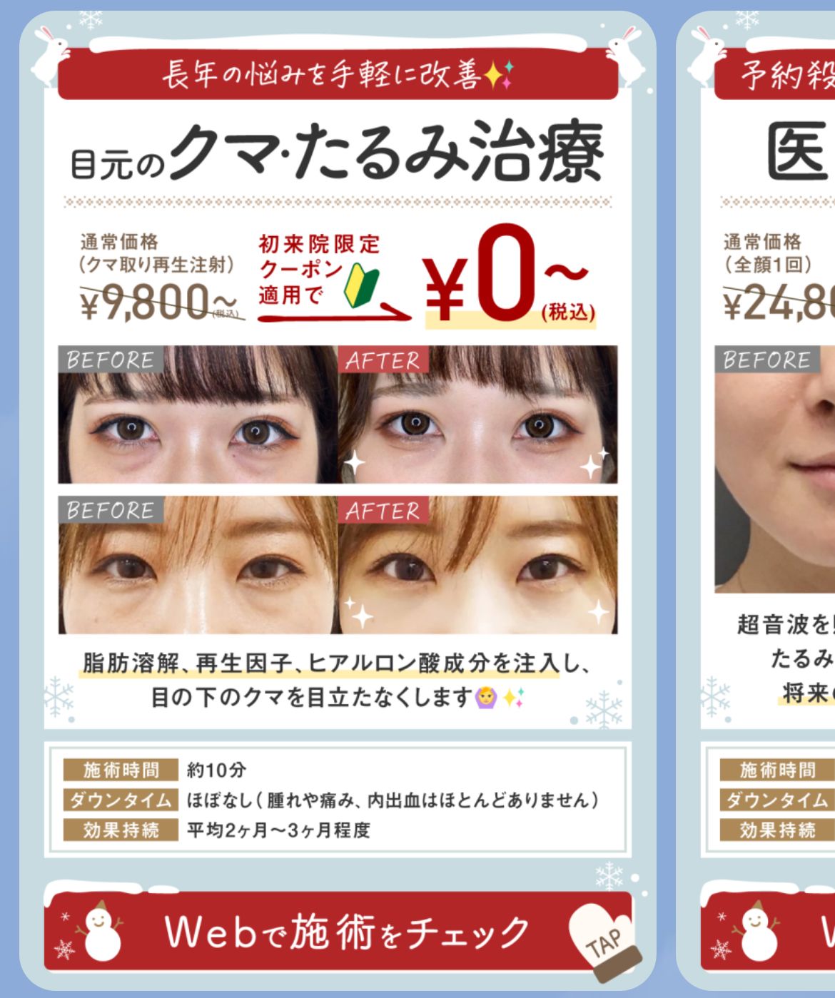 メニュー無料の参考画像